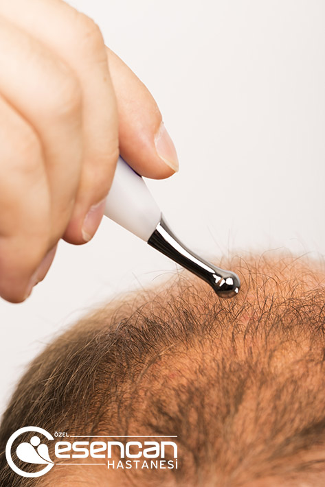 hair-transplant-4 hair-transplant-4