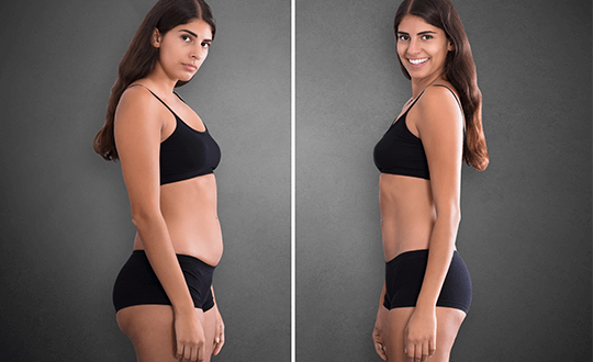 liposuction-first-2 liposuction-first-2