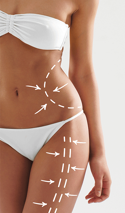 liposuction-middle-3 liposuction-middle-3