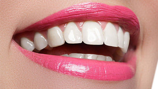 hollywood-smile-8 hollywood-smile-8