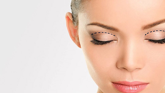 upper-eyelid-2 upper-eyelid-2