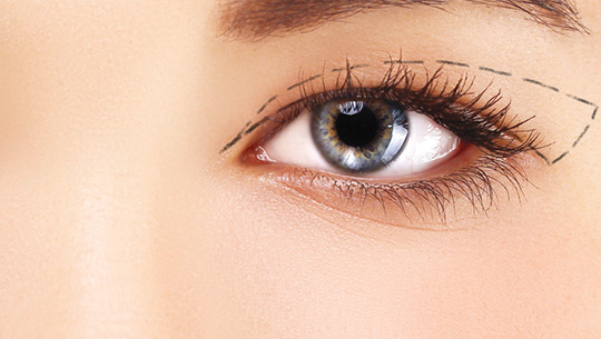 upper-eyelid upper-eyelid