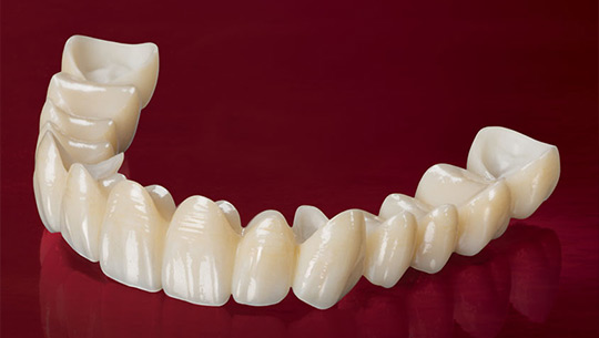 zirconia-crowns-2 zirconia-crowns-2