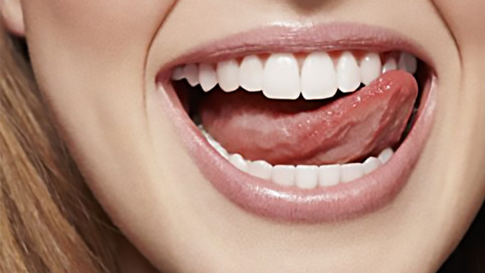 zirconia-crowns-5 zirconia-crowns-5