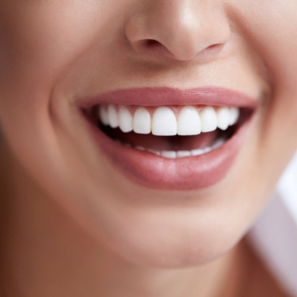 Estetik Gülüş Tasarımı